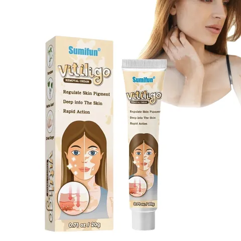 Kem đốm trắng Vitiligo removal cream kem làm sạch bạch biến chăm sóc da làm giảm các đốm trắng trên