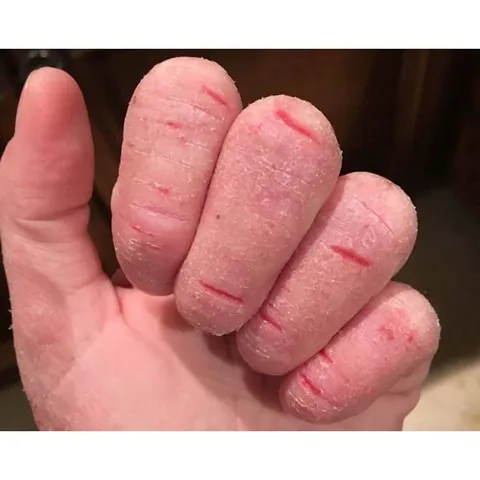 2 Tuýp bôi thảo mộc cực hiệu quả