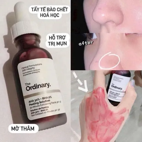 Serum The Ordinary AHA 30% + BHA 2% Peeling solution