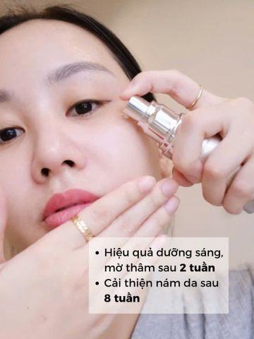 Serum xóa Nám Thế hệ mới Casmara Clarifying Concentrated Serum 30ml