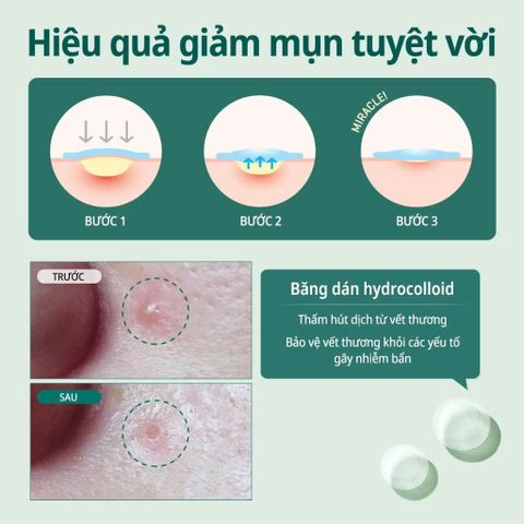 Miếng Dán Mụn Some By Mi Clear Spot Patch - 18 Miếng Bảo Vệ Da, Hút Nhân Mụn, Chống Nước, Dành Cho Da Nhạy Cảm 729412