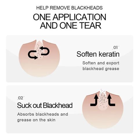 Kem lột Mụn Than Tre Hút sạch mụn cám, mụn đầu đen. Thải độc chì- Sáng da