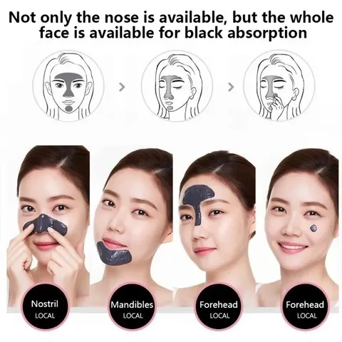 Kem lột Mụn Than Tre Hút sạch mụn cám, mụn đầu đen. Thải độc chì- Sáng da