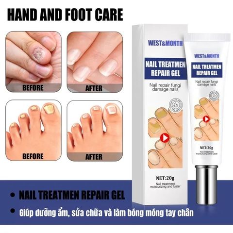 Kem nấm móng móng tay chăm sóc Nấm móng tay 20g Cải thiện vết nứt móng tay giảm nhiễm nấm kích thích mọc