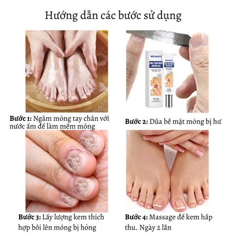 Kem nấm móng móng tay chăm sóc Nấm móng tay 20g Cải thiện vết nứt móng tay giảm nhiễm nấm kích thích mọc