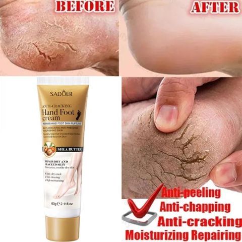 Kem dưỡng chân Kem dưỡng da tay Kem Chống Nẻ 60g Dưỡng Ẩm Chống Nẻ Da Tay Chân á sừng Bong da Nứt Gót Chân