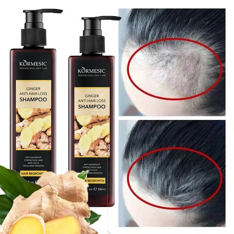 Dầu gội kích thích mọc tóc Dầu gội mọc tóc Giảm Gãy Rụng Dầu Gội Mọc Tóc Nhanh kiểm soát dầu loại bỏ gàu