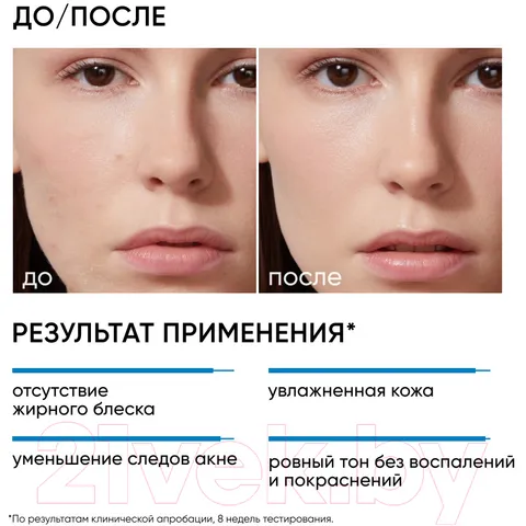 💗 Icon Skin Kem Dưỡng Da Moist And Heal Anti Acne Cream 30ml – Dưỡng Ẩm, Giảm Mụn, Làm Dịu Da, Phù Hợp Da Hỗn Hợp Và Dầu