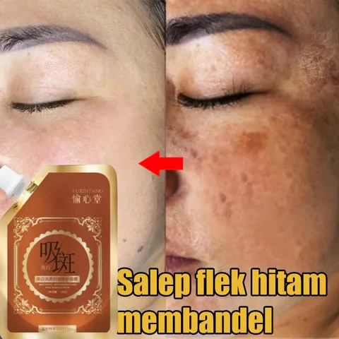 Mặt Nạ Lột YUXINTANG Cao Cấp - Công Nghệ Hàn Quốc Đánhh Bayy Đốm Đen, Làm Căng Da Giảm Nhăn Hiệu Quả