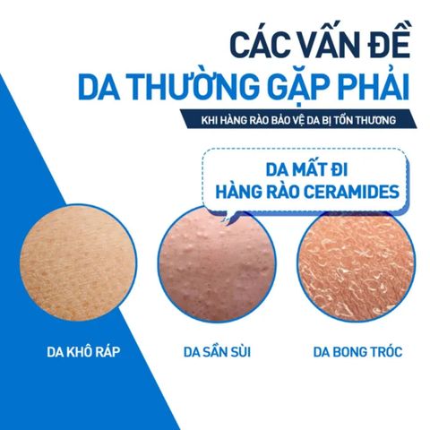 Kem Dưỡng Ẩm CeraVe Dành Cho Da Khô 50ml - Giải Pháp Chăm Sóc Da Khô Mịn Màng, Hấp Thụ Nhanh, Làm Da Tươi Trẻ