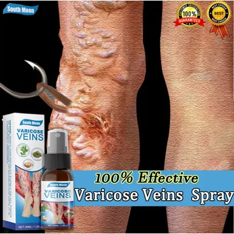 Xit Phục Hồi Tĩnh Mạch Xit Phục Hồi Tĩnh Mạch Mở Tĩnh Mạch Và Giảm Đau Do Giãn Tĩnh Mạch Chân