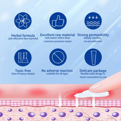 Kem Giảm Ngứa 20g Xịt chống ngứa Xịt bệnh chàm bệnh vảy nến hắc lào mề đay lang ben á sừng viêm da nấm giảm ngứa