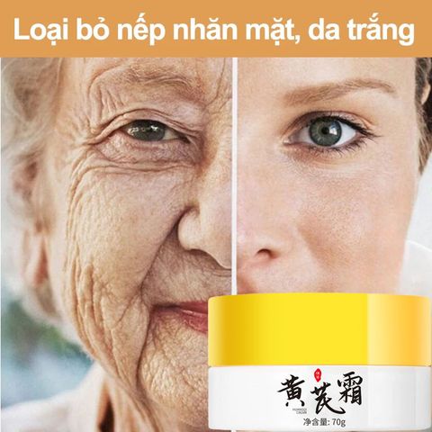 Kem xóa tàn nhang 70g kem ngừa nám Chuyên sâu Loại bỏ các đốm đen Sắc tố làm sáng da Săn chắc da kem dưỡng ẩm cho mặt