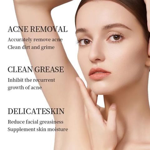 AZELAIC ACID Kem chấm mụn bỏ các loại mụn, mụn đầu đen,mụn ở tuổi dậy thì,loại bỏ mụn bọc cho da dầu
