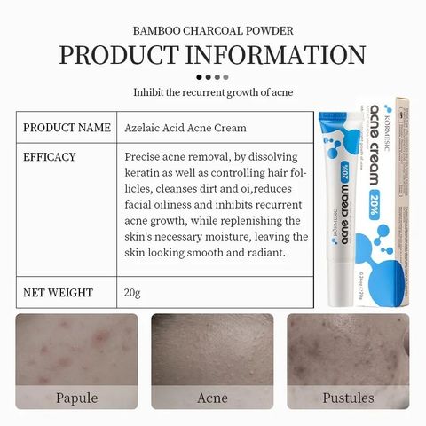 AZELAIC ACID Kem chấm mụn bỏ các loại mụn, mụn đầu đen,mụn ở tuổi dậy thì,loại bỏ mụn bọc cho da dầu