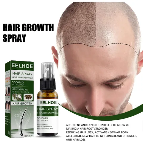Xịt Mọc Tóc , Giảm Rụng Tóc Và Kích Thích Mọc Tóc