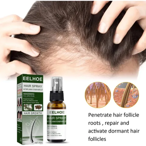 Xịt Mọc Tóc , Giảm Rụng Tóc Và Kích Thích Mọc Tóc
