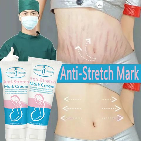 [Loại Bỏ Sẹo] Kem Xóa Sẹo Nhanh Chóng, Vết Bỏng, Sẹo Trầy Xước, Sẹo Sau Phẫu Thuật, Vết Rạn Da