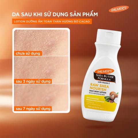 Size 50ml Lotion dưỡng ẩm toàn thân hỗ trợ làm mềm mịn da hương Bơ Hạt Mỡ Palmer's raw shea butter body lotion 50ml