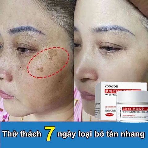 Kem nám tàn nhang Kem dưỡng trắng da mặt 50g kem trắng da mặt kem nám kem tàn nhang kem xóa tàn nhang