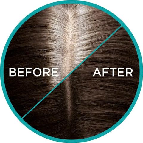 Xịt phủ bạc tạm thời che phủ chân tóc L'Oreal Paris Magic Retouch chai 75ml
