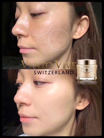 Vento Vivere Pearl Rare Illuminating Cellular Cream - Kem Trắng Da, Giảm Nám Từ Ngọc Trai Thụy Sĩ