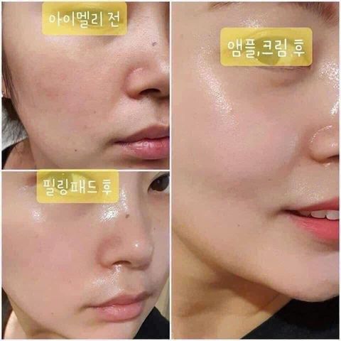 Viên tinh chất Collagen JM Multi Vita Capsule Ampoule - Serum làm sáng da, tăng độ đàn hồi, hỗ trợ phục hồi da  .