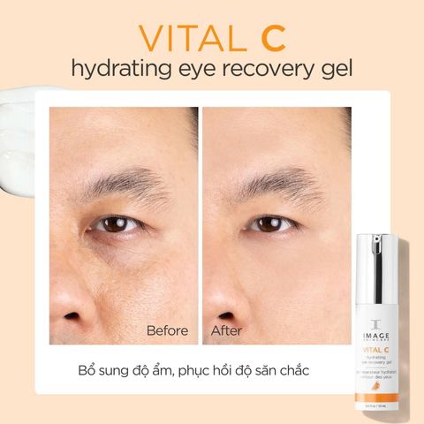 Kem mắt Image Skincare Vital C Hydrating Eye Recovery Gel giảm thâm cuồng mắt , nếp nhăn thương hiệu từ Mỹ