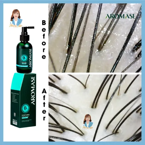 Xịt dưỡng tóc, giảm viêm da đầu Đài Loan AROMASE Herbal Cooling Scalp Care Spray 40ml - cho da dầu
