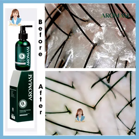 Xịt dưỡng tóc, chăm sóc da đầu Đài Loan AROMASE Herbal Scalp Care Spray 40ml - cho da đầu khô