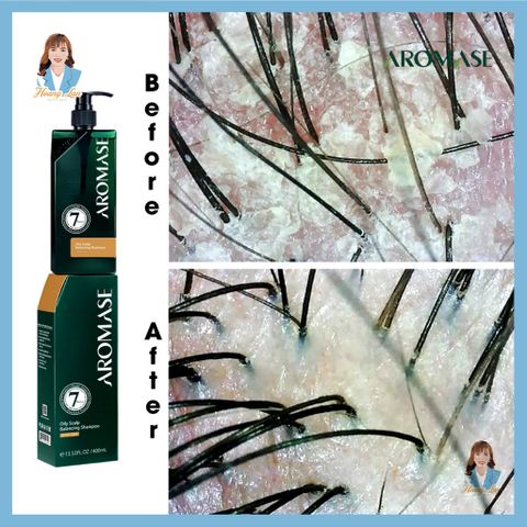 Dầu gội ngăn gàu, giảm nhờn da đầu, ngăn bết tóc Đài Loan AROMASE Oily Scalp Balancing Shampoo 400ml