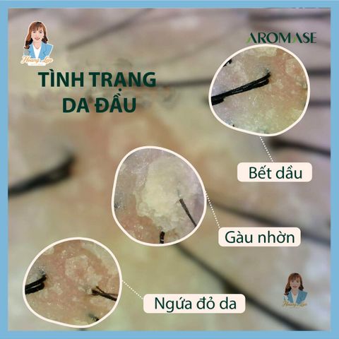 Dầu gội ngăn gàu, giảm nhờn da đầu, ngăn bết tóc Đài Loan AROMASE Oily Scalp Balancing Shampoo 400ml