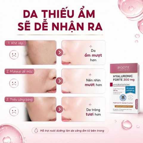 Viên Uống Nâng Cơ Ngăn Lão Hoá Da Biocyte Hyaluronic Forte 300 mg - Giải Pháp Làm Đẹp Đến Từ Pháp, 90 Viên