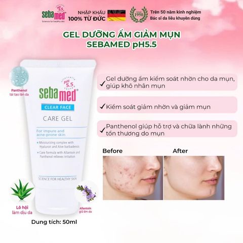 Gel dưỡng ẩm dành cho da dầu mụn, kem dưỡng chuẩn cân bằng Sebamed Clear Face Care Gel pH5.5 (50ml)