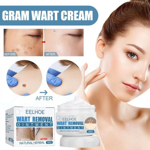 Kem mụn cóc kem tẩy nốt ruồi mụn cóc 50g 7 ngày loại bỏ nốt ruồi mụn cóc mụn thịt nhanh chóng ann toànn và không đau