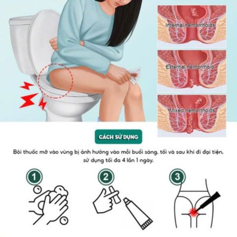 Kem Bôi Trĩ Kreain Nature Soothing Cooling - Kem Trĩ Thảo Dược Giảm Sưng Rát, Mát Lạnh, Dịu Nhẹ Vùng Hậu Môn 20g