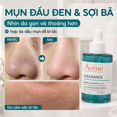 (sale date 5/27)Tinh Chất Dưỡng Da Avene Cleanance AHA Exfoliating Serum 30ml - Tẩy Tế Bào Chết Dành Cho Da Nhạy Cảm, Giảm Khuyết Điểm, Làm Mịn và Sáng Da