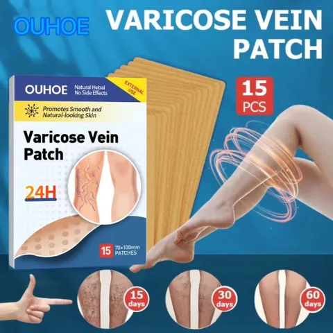 Giãn tĩnh mạch Miếng dán giảm giãn tĩnh mạch giảm mỏi phù nề tê chân giảm nổi gân xanh trên da