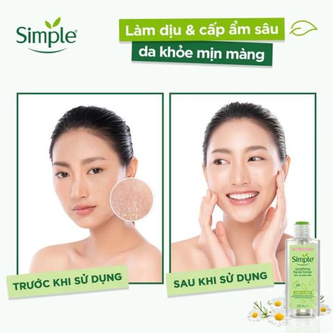 Nước Hoa Hồng Simple Soothing Facial Toner 200ml - Làm Dịu Và Cấp Ẩm Cho Da