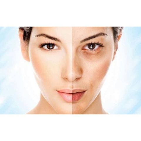 Serum BALEA Vitamin C giúp trắng da, giảm thâm