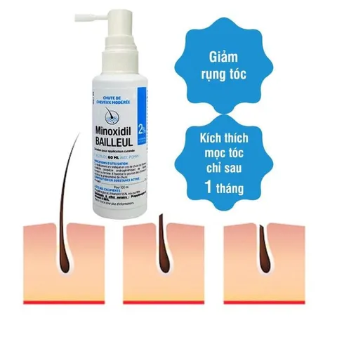 Xịt Minoxidil giảm rụng tóc,giúp tóc chắc khỏe