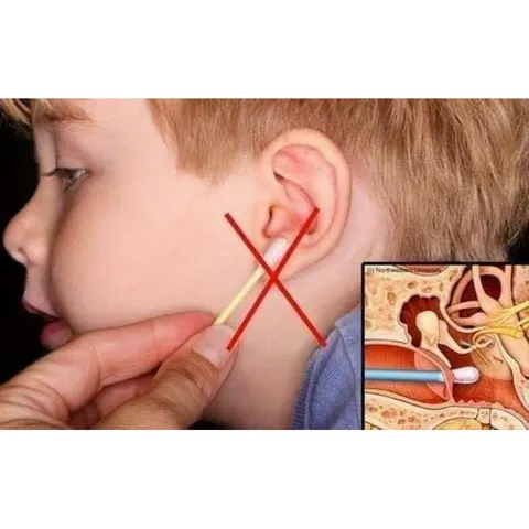 Xịt tan ráy tai Mivolis, an toàn,dễ sử dụng,làm sạch ráy tai,lọ 20ml