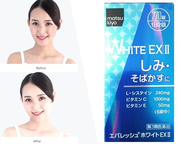 Viên Uống Trắng Da WHITE EX II Mờ Thâm Nám Bật Tông Hiệu Qủa 270 Viên Nhật Bản
