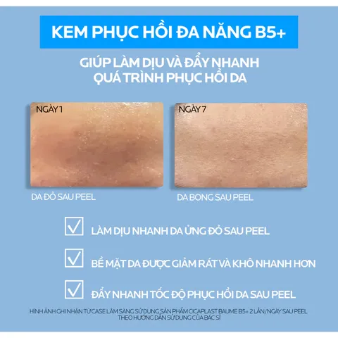 Kem Dưỡng Làm Dịu Da La Roche-Posay Cicaplast B5+ Baume 100ml – Phục Hồi Da, Giảm Kích Ứng