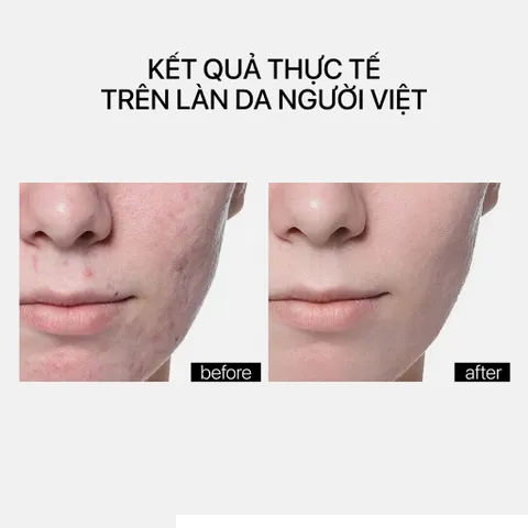 Tinh Chất Phục Hồi THERAMID COPPER PEPTIDE 30ml