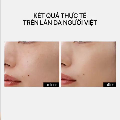 Serum Dưỡng Ẩm Cho Da THERAMID LINO-8 30ml