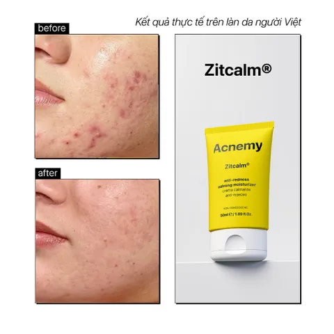 Kem giảm đỏ và làm dịu da ACNEMY CALMING MOISTURIZER 50ml