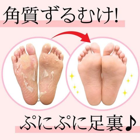 Túi Ủ Tẩy Tế Bào Chết Da Chân Lavender To-Plan - Nội Địa Nhật Bản [Chính hãng]