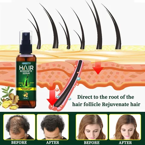 Serum dưỡng mọc tóc, giúp tóc mọc nhanh, nhiều và dày, sợi tóc đen bóng - Xuất xứ Nhật Bản – Mã 1230