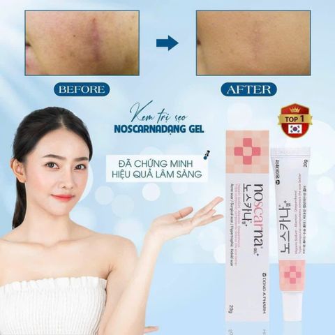 Kem Sẹo NOSCARNA Nội Địa Hàn Quốc - Làm Mờ Sẹo. Tuýp 20g